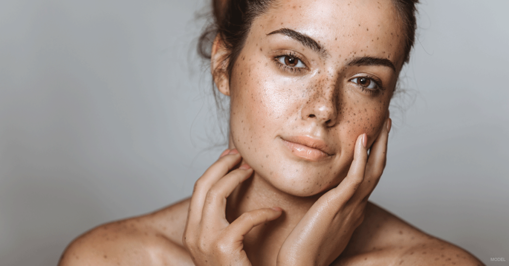 Woman with freckles looking at camera