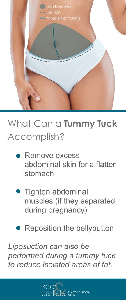 Things a tummy tuck can accomplish, remove excess abdominal skin for a flatter stomach, tighten abdomincal muscles, and reposition the bellybutton