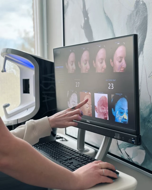 Our VISIA Skin Analysis can provide an inside glimpse into the health of your skin.

This device captures three images of your skin, measuring your skin's condition in relation to the following categories: spots, wrinkles, texture, pores, UV spots, brown spots, red areas, and porphyrins. We also utilize the VISIA to track the progress of your skin journey at our office.

Interested in seeing what the VISIA will uncover for you? We would love to offer you a complimentary VISIA and skincare consultation at our spa!

Schedule your complimentary skincare consultation by calling our office:
515-277-5555 | press "2" for our spa