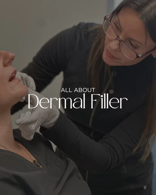 We are proud to offer complimentary injection consultations to our patients! 

Dermal filler can plump and rejuvenate the following areas:
➡ Smoothing facial lines and wrinkles
➡ Adding volume and improving the contours of the cheeks, chin, and jaw
➡ Filling in thin or wrinkled lips
➡ Correcting nasolabial folds or “smile lines”
➡ Diminishing the appearance of acne scars

Injectable fillers are a temporary solution for these concerns, so the best candidates have realistic goals and expectations.

If you are interested in meeting with one of our expert injectors, we encourage you to reach out to our office:
🩵 515-277-5555 | press "1" for our medical office
🩵 Inquire online: https://www.kochandcarlisle.com/consultation-mobile/