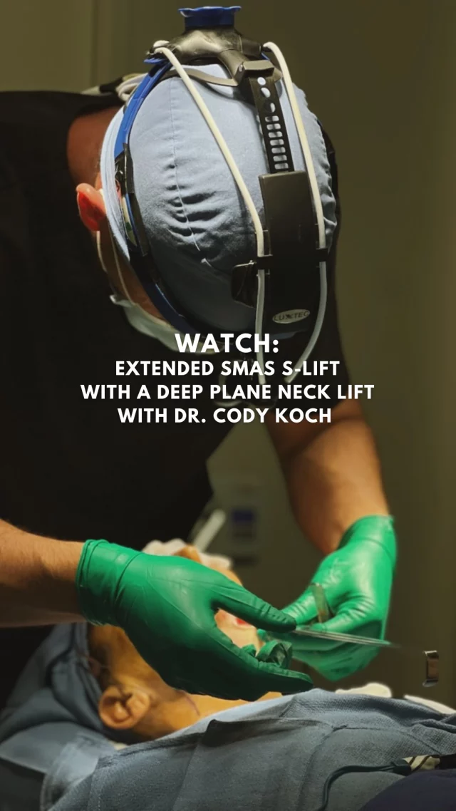 We meet with Dr. Cody Koch again for the next part of his patient’s transformation: the neck! 

Curious about what goes into creating a sharper, more youthful neck and jawline? 

Dr. Koch walks you through the steps of a platysmaplasty — a surgical technique that tightens the underlying neck muscles for long-lasting, natural results. 🙌