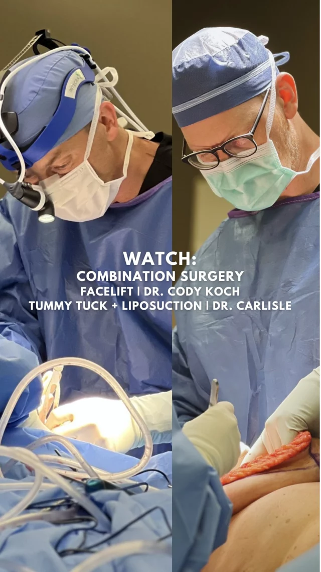 A month ago, our patient received both a facelift by Dr. Cody Koch, along with a tummy tuck paired with liposuction by Dr. Michael Carlisle. These procedures were performed on the same day by both providers. 

Listen along as Dr. Carlisle describes our patient’s journey through her surgeries. 

Today, she is healing fabulously! 🙌

Are you interested in speaking with our board-certified plastic surgeons? We’re happy to help and get you set up for an in-person consultation.
Speak with a member of our team | 515-277-5555
Inquire online | https://www.kochandcarlisle.com/consultation-mobile/

#westdesmoines #kochandcarlisleplasticsurgery #tummytuck #tummytucksurgery #faceliftsurgery #facelift #boardcertifiedplasticsurgeon #boardcertified #liposuction