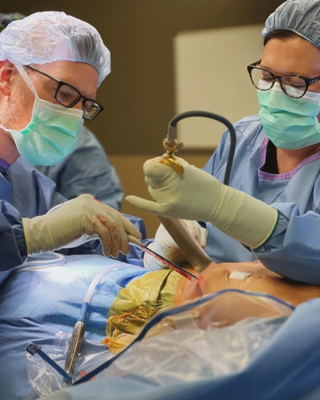 📸: Dr. Carlisle and his PA, Brooke,  working together on a breast augmentation case at West Lakes Surgery Center.

(Stay tuned to see our patient's results! 👀👏)

Many women are unsure of whether they need breast augmentation or a breast lift. While both are breast enhancement procedures, they provide different benefits. In simple terms, breast augmentation increases size, and breast lift surgery reduces sagging.

Breast augmentation adds fullness to one or more breasts. It does not correct noticeable sagging or reshape the areolas.

Are you curious if you might be a candidate for breast augmentation? We'd love to help! Reach out today to learn more about this procedure and our process at Koch & Carlisle Plastic Surgery & Spa:

➡ Inquire online | ask@kochmd.com
➡ Speak with a member of our team | 515-277-5555
.
.
.
.
.
#breastaug #breastaugmentation #boardcertified #boardcertifiedplasticsurgeon #westdesmoines #westdesmoinesiowa #kochandcarlisleplasticsurgery