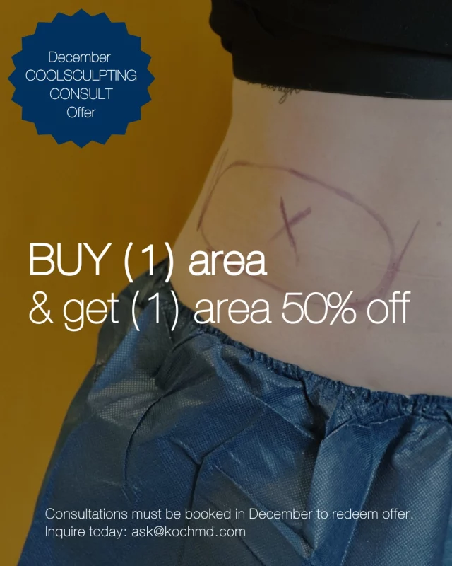 ❄ Buy (1) CoolSculpting area and unlock an additional area at 50% off*! 

Unlock this exclusive offer when you book a complimentary CoolSculpting consultation in December!

CoolSculpting uses a controlled cooling process called cryolipolysis to kill fat cells that lie just beneath the skin, while leaving surrounding tissues unharmed. The body gradually flushes away the dead fat cells through its natural cleansing process, and treated areas become slimmer.

Many areas of the body can be treated with CoolSculpting including the abdomen, flanks, thighs, back, under the buttocks, double chin and arms. 

Interested in learning more about CoolSculpting? We would love to help!
➡ Inquire Online | ask@kochmd.com
➡ Speak with a member of our team | 515-277-5555, press "2" for the spa