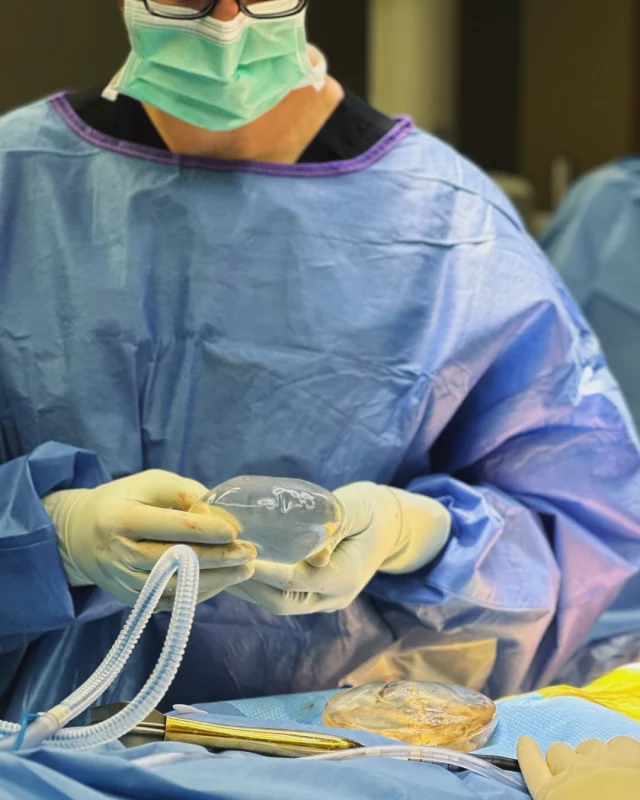 Breast Augmentation is one of our most popular procedures performed by Dr. Michael Carlisle, MD at Koch & Carlisle Plastic Surgery & Spa.

Breast Augmentation is a great option for those who wish to restore volume lost after pregnancy, increase the size of naturally small breasts, improve uneven or asymmetrical breasts, or simply to enhance feminine proportions and contours. 

While there are many options for implants, the most commonly used implant is a smooth round silicone implant because of its natural feel and safety record. 

During your consultation, Dr. Carlisle will help you decide which implant is best based on your body type, concerns, and goals.

Interested in learning more? We're here to help: 
➡ Speak with a member of our team | 515-277-5555, press "1" for our medical office
➡ Inquire online | https://www.kochandcarlisle.com/consultation-mobile/
➡ Visit our "breast augmentation" photo gallery | https://www.kochandcarlisle.com/photo-gallery/