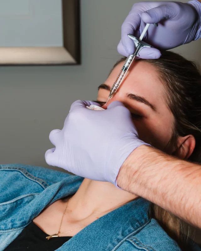 📸: Dr. Cody Koch, MD, PhD performing a liquid rhinoplasty at Koch & Carlisle Plastic Surgery.

A liquid rhinoplasty, also called a liquid nose job, is a nonsurgical procedure that reshapes the nose with dermal filler injections. It is best for making subtle improvements to the bridge or tip of the nose.

Patients are often amazed at the changes that nonsurgical rhinoplasty can accomplish. A liquid rhinoplasty can effectively camouflage imperfections such as dorsal humps and droopy nasal tips.

While it is more affordable than surgical rhinoplasty and requires no downtime, liquid rhinoplasty cannot correct breathing problems and provides temporary results.

Interested in learning more about a liquid rhinoplasty or rhinoplasty at Koch & Carlisle Plastic Surgery? We're here to help:
➡ Speak with a member of our team | 515-277-5555, press "1" for consultations
➡ Inquire Online | ask@kochmd.com