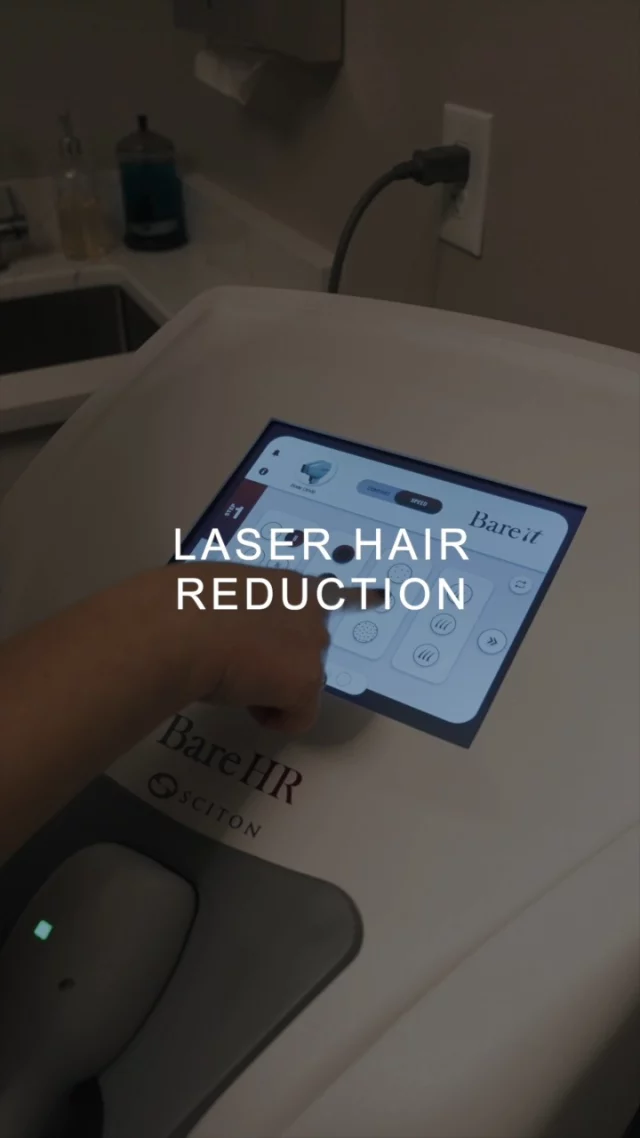 Laser Hair Reduction at Koch & Carlisle Spa is offered all year long and provides our patients with lasting results! 

Hair reduction utilizes light energy to destroy and disable hair follicles, permanently reducing hair growth in the targeted area. It is an effective solution for unwanted hair in areas such as: legs and bikini area, underarms, chin and cheeks, as well as the back and shoulders.

Our aesthetic team offers permanent hair reduction technology that is appropriate and effective for people of all skin and hair types.

This quarter: save 20% when you purchase a series of 6 treatments! (We recommend 6 treatments for optimal results!)

Reach out today to learn more: ask@kochmd.com | 515-277-5555, press "2" for our spa