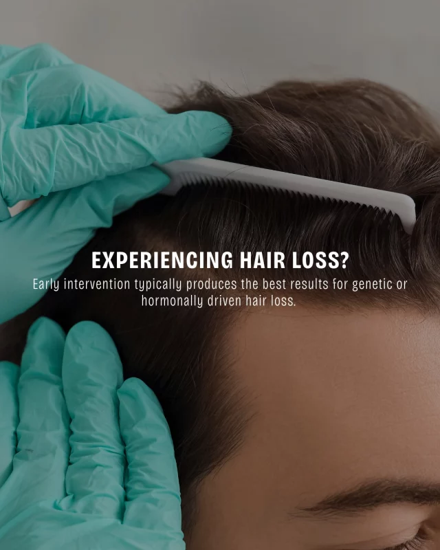 Early intervention typically produces the best results for genetic or hormonally driven hair loss. 

We tailor a comprehensive strategy that may include topical treatments, platelet-rich therapies, and surgical solutions for patients seeking lasting restoration.

There is no one-size-fits-all answer; what constitutes the “best” treatment must reflect your hair loss type, donor hair availability, overall health, and aesthetic goals.

Dr. Katie is here to help you find the best solution to addressing hair loss.

Reach out today to schedule a complimentary hair loss consultation to learn more about our hair restoration services at Koch & Carlisle Plastic Surgery & Spa:
➡ Speak with a member of our team | 515-277-5555
➡ Inquire Online | https://www.kochandcarlisle.com/consultation-mobile/