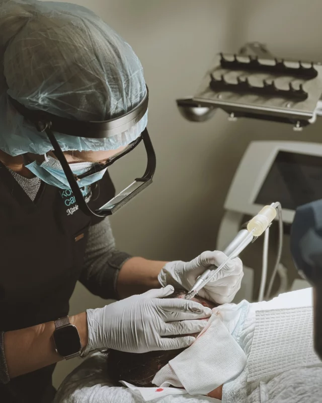 "Is NeoGraft Hair Restoration Permanent?"

NeoGraft results are long-lasting, and many patients enjoy permanent hair growth in the treated areas. Because transplanted follicles are typically resistant to hair loss, they continue to grow naturally for years to come. 

While NeoGraft does not stop future hair loss in untreated areas, some patients choose to return for touch-up sessions. We can help create a customized maintenance plan based on your goals and hair health. 

At Koch & Carlisle Plastic Surgery & Spa, Dr. Katie creates custom hair restoration plans for patients based on a few factors: hair loss type, donor hair availability, overall health and aesthetic goals. 

Contact us to set up a complimentary hair loss consultation with Dr. Katie, and determine the most effective plan for preserving or restoring your hair:
➡ Speak with a member of our team | 515-277-5555
➡ Inquire Online | https://www.kochandcarlisle.com/consultation-mobile/