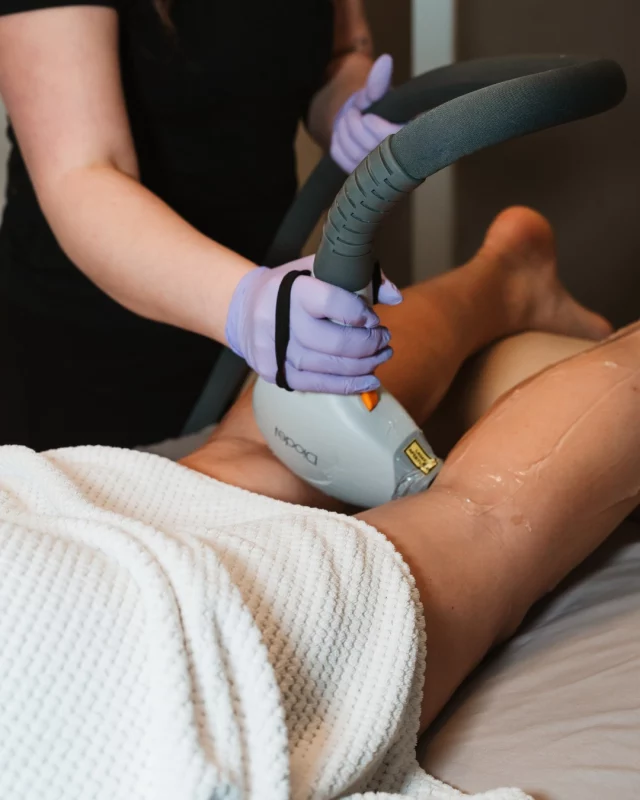 Did you know… most people can expect a 10–25% hair reduction with each laser hair reduction treatment?

Another bonus: the hair that does grow back is typically finer and lighter. 👏

Laser hair reduction can treat a variety of areas, including the arms, legs, underarms, chin, face, bikini, and the brazilian area.

Until the end of March, receive 20% off a laser hair package, which includes a series of 6 treatments. (We recommend a series of 6 for optimal results!)

Interested in learning more? Reach out today to set up a complimentary skincare consultation:
➡ Speak with a member of our team | 515-277-5555, press “2” for Koch & Carlisle Spa
➡ Inquire online | https://www.kochandcarlisle.com/consultation-mobile/