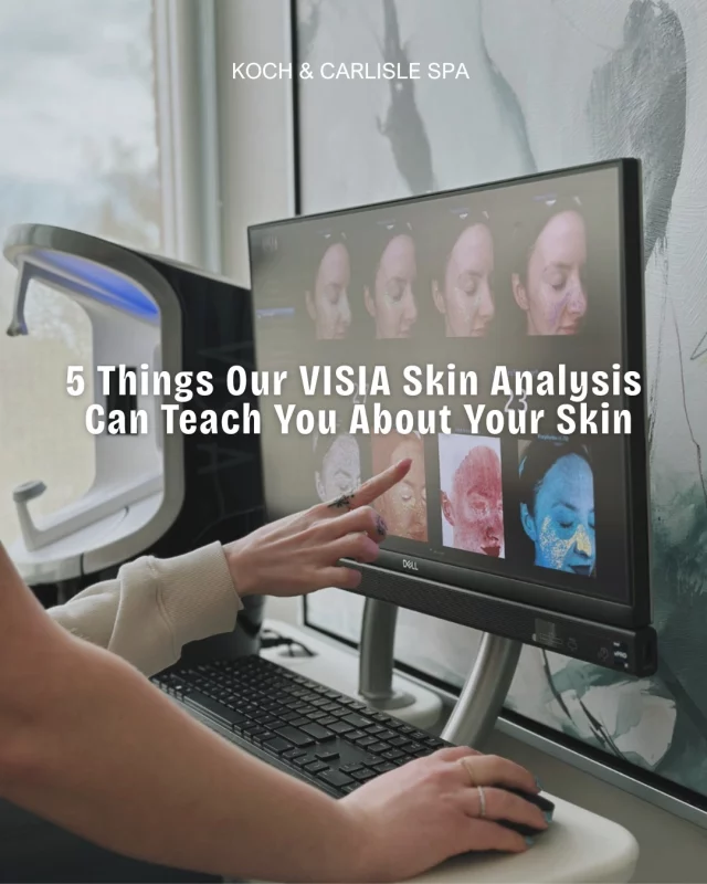 Entering your bridal era, or trying to get a better understanding of which products are best for your skin? We like to start with the VISIA!

We offer complimentary VISIA facial scans at Koch & Carlisle Spa, which provide an in-depth look at the current status of your skin.

Once your photos are captured, the VISIA provides data in several categories, ultimately teaching you a few things about your skin:
✔ Your true level of sun damage (even sun damage you haven’t seen yet)
✔ How quickly your skin is aging
✔ What’s happening inside your pores
✔ The source of your skin’s redness and inflammation
✔ Your overall skin health, broken down into detailed categories

The best part? Your aesthetician can track your progress as you continue through your customized skincare plan.

Reach out today to schedule a complimentary skincare consultation and VISIA scan:
🩵 Book Online | https://book.mypatientnow.com/practice/SxtdUw
🩵 Speak with a member of our team | 515-277-5555, press "2" for our spa
